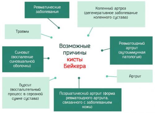 RUC2 - Способ лечения синовитов и/или синовиальных кист - Google Patents